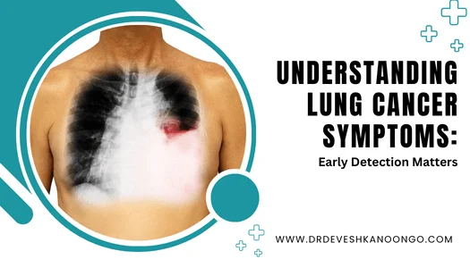 chest diagram that infected to lungs cancer