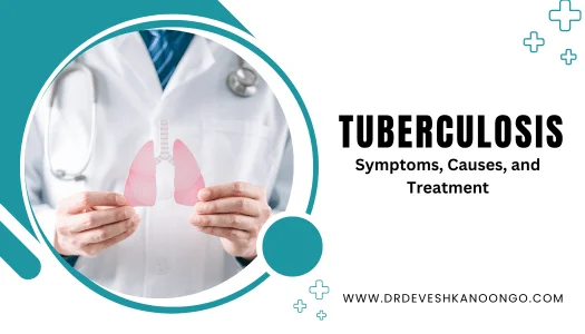 tuberculosis