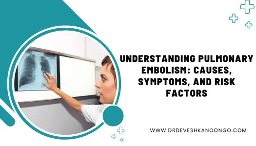 pulmonary embolism