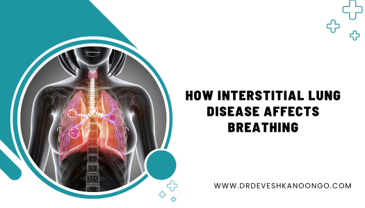 How Interstitial Lung Disease Affects Breathing