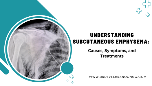 Will Understand the subcutaneous emphysema in this blog