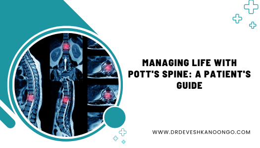Managing Life with Pott's Spine A Patient's Guide