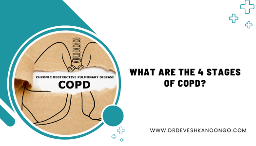 What Are The 4 Stages Of COPD- Dr. Devesh Kanoongo