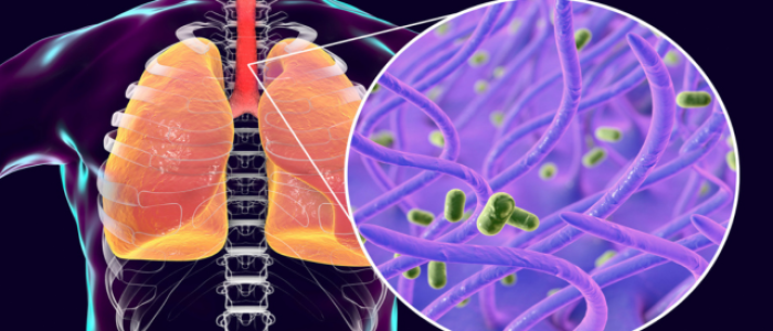 Treating Lung Infections